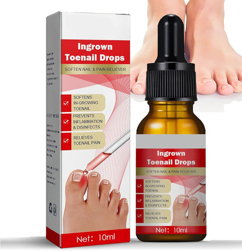 Ingrown toenail treatment - ingrown,