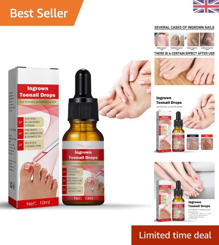 Ingrown toenail correction - toenail,