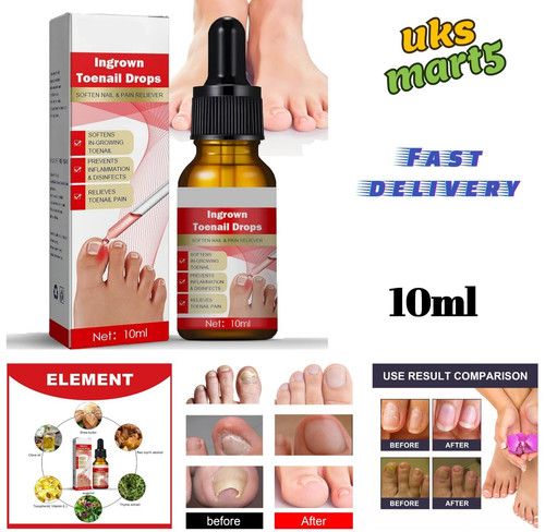 Ingrown toenail treatment drop - ingrown,
