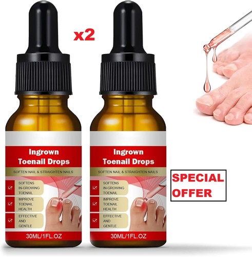 Ingrown toenail treatment - ingrown,