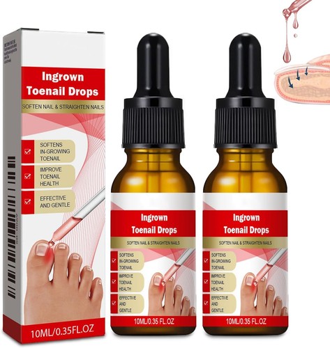 Ingrown toenail softening - toenail,