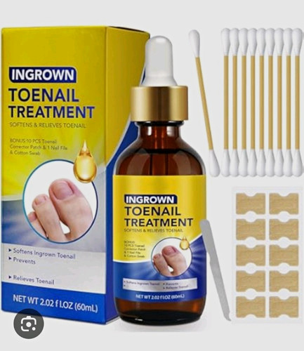Sefudun ingrown toenail - ingrown,