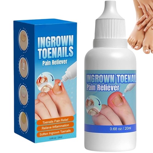 Ingrown toenail treatment - ingrown,