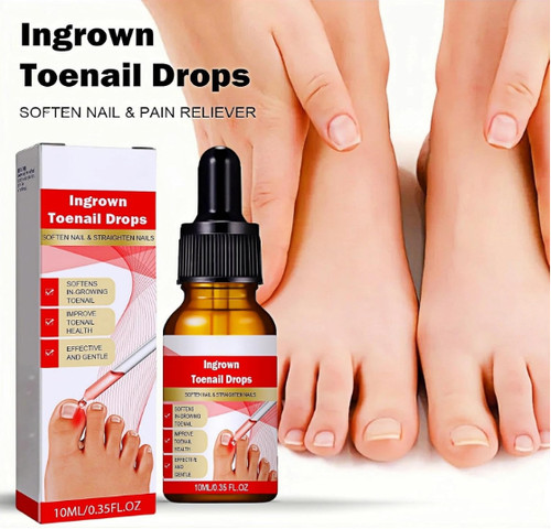 Ingrown toenail treatment - ingrown,
