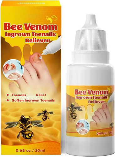 Ingrown toenail treatment - ingrown,