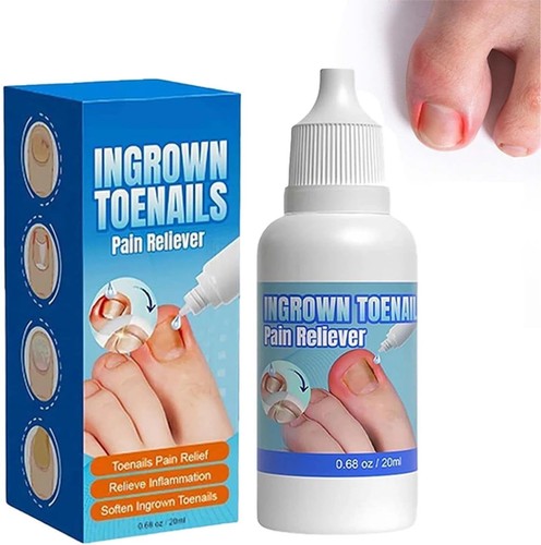 Ingrown toenail treatment - ingrown,