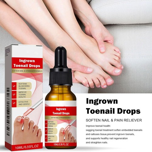 Ingrown toenail treatment - ingrown,
