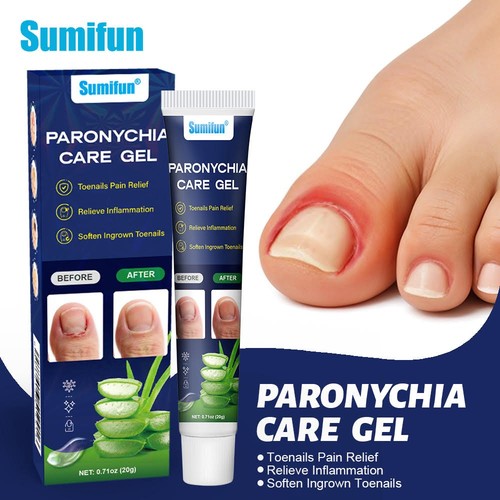 New natural paronychia care - new,