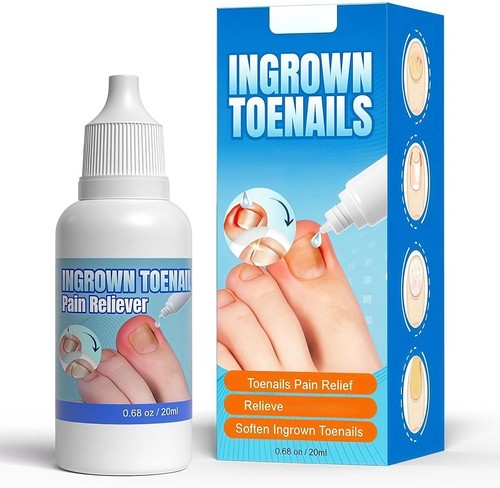 Ingrown toenail treatment - toenail, &