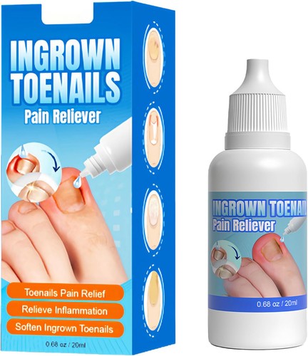 Ingrown toenail drops - ingrown,