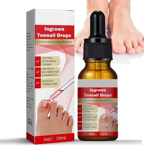 Ingrown toenail treatment - ingrown,