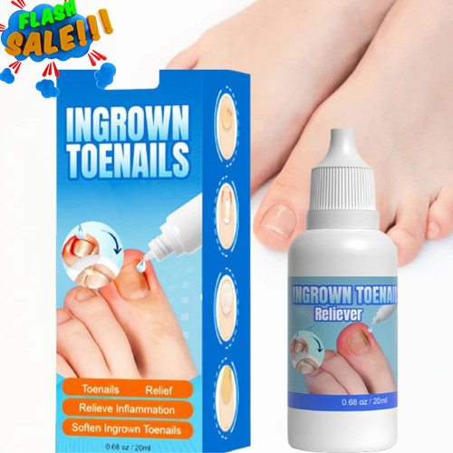 Ingrown toenail drops - ingrown,
