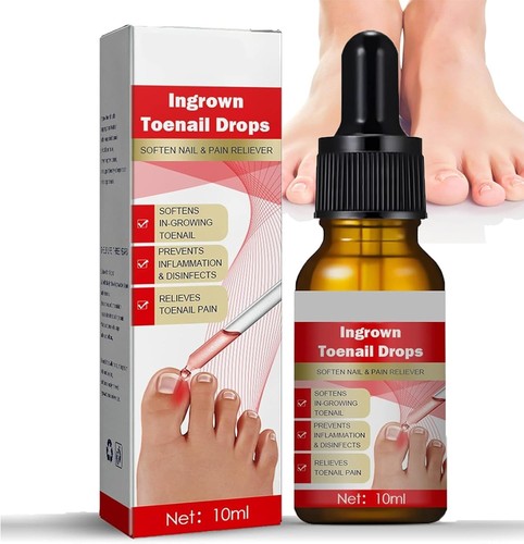 Ingrown toenail treatment - toenail,