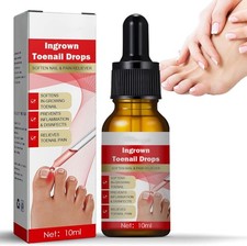 Ingrown Toenail Treatment Drop