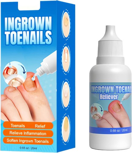 Ingrown toenail drops - drops,,