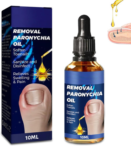 Ingrown toenail treatment - ingrown,