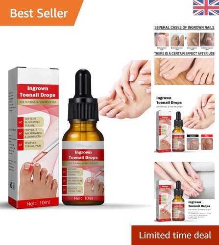 10ml ingrown toenail - 10ml,