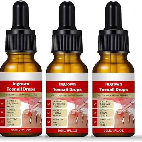 3pcs ingrown toenail treatment - toenail,