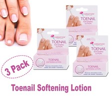 Carnation Toenail Softening