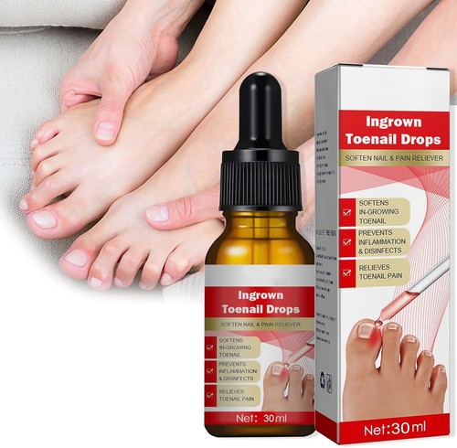 Ingrown toenail treatment - toenail,