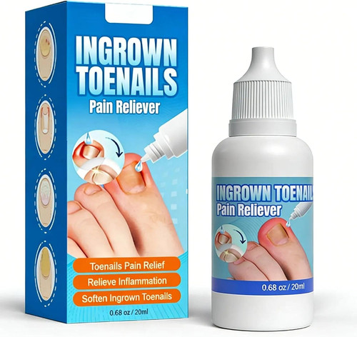 Ingrown toenail treatment - toenail,