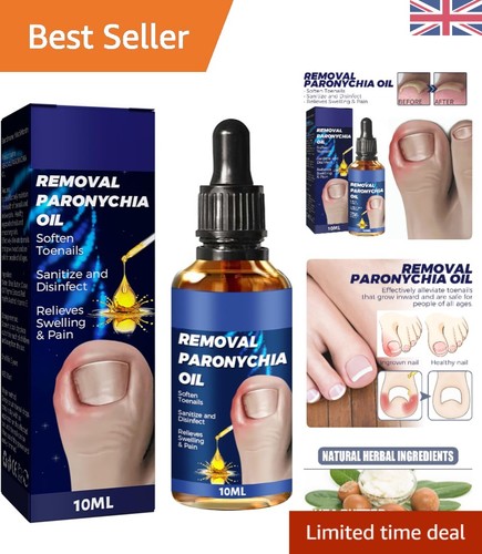 10ml ingrown toenail - 10ml,