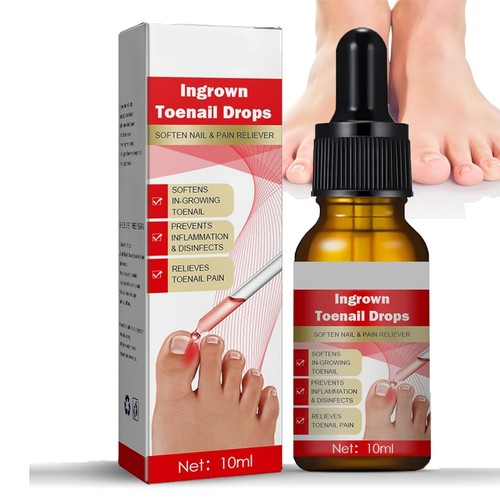 Ingrown toenail treatment - ingrown,