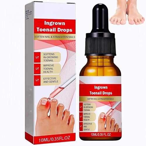 Ingrown toenail treatment - toenail,