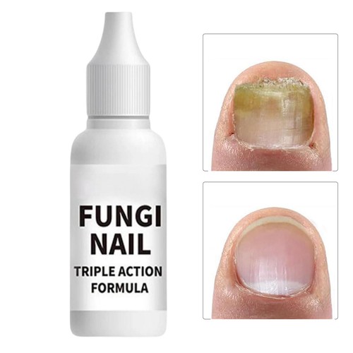 Natural nail care 15ml extra - nail,