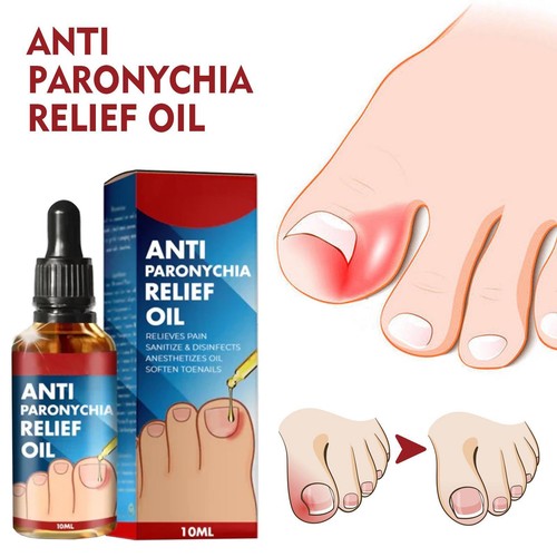 Professional ingrown toenail - ingrown,