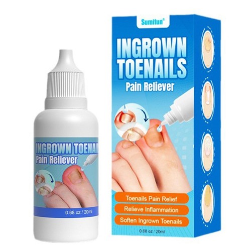 Ingrown toenail drops - ingrown,