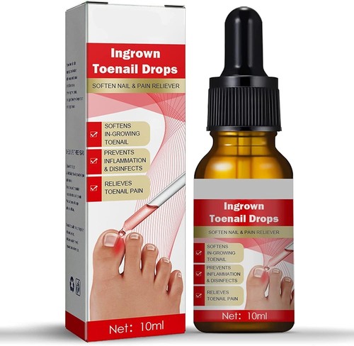 Ingrown toenail treatment - ingrown,