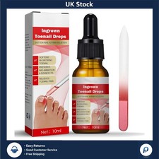 Ingrown Toenail Correction