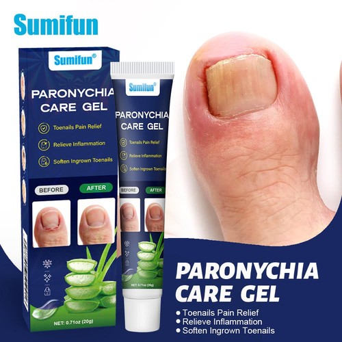 20g new natural paronychia - 20g,