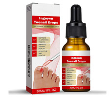Ingrown Toenail Treatment