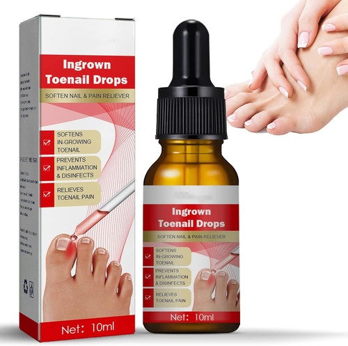 Ingrown toenail treatment - toenail,